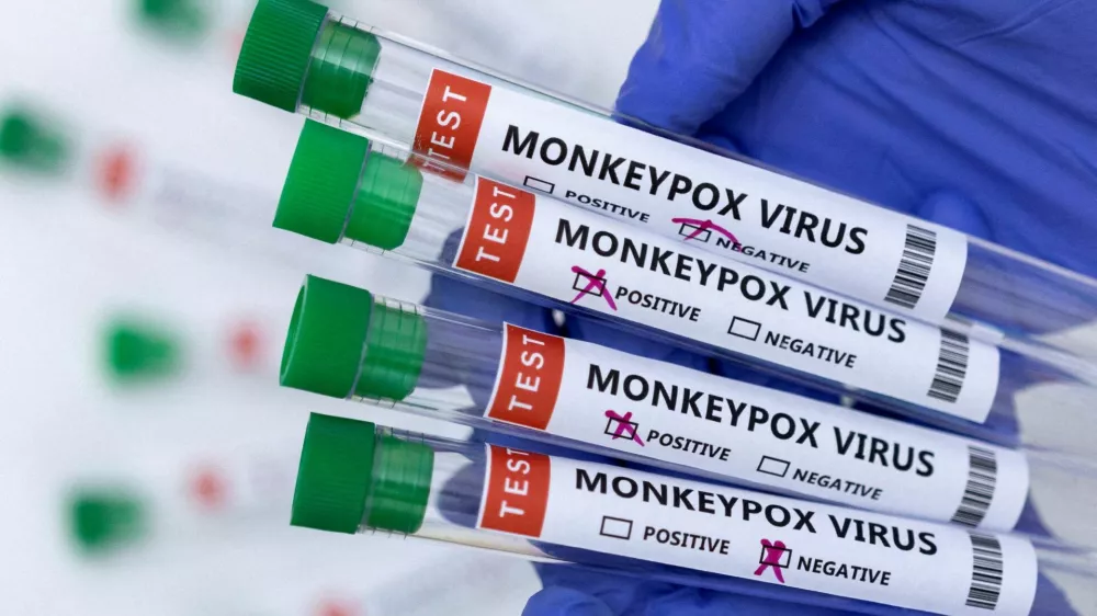 FILE PHOTO: Test tubes labelled "Monkeypox virus positive and negative" are seen in this illustration taken May 23, 2022. REUTERS/Dado Ruvic/Illustration/File Photo