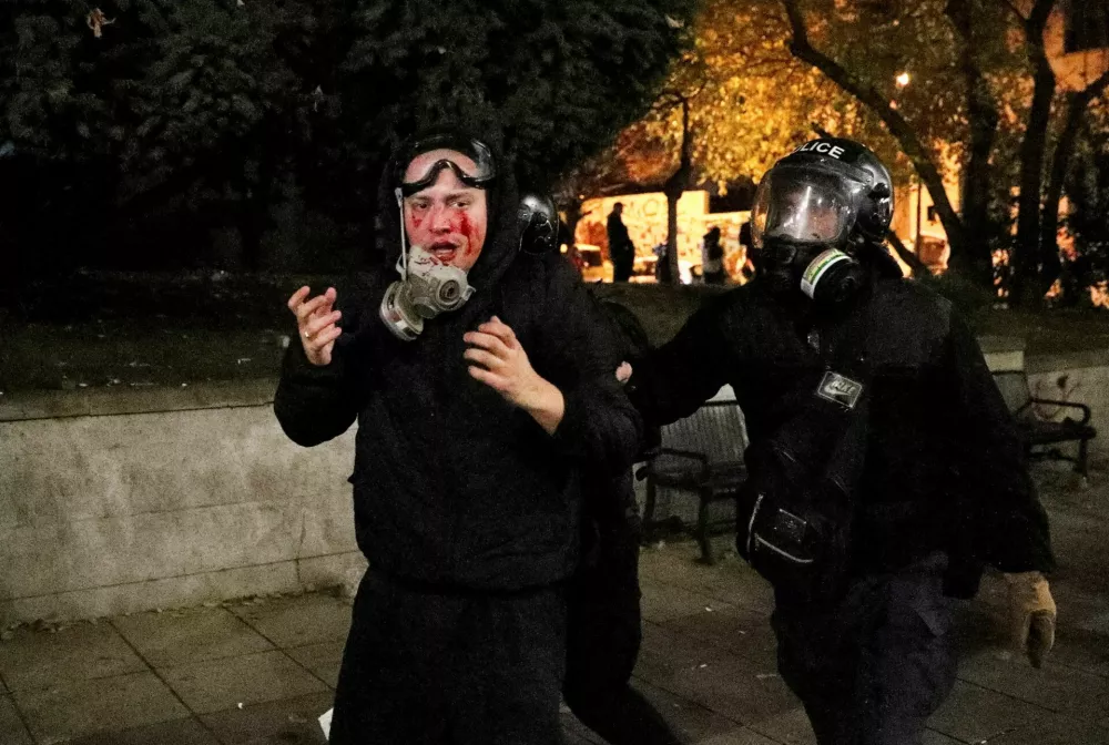 Varuh človekovih pravic Levan Ioseliani je nedavno oblasti obtožil, da policija uporablja nasilje nad protestniki kot kaznovalni ukrep. Kajti večina poškodb, ki so jih utrpeli pridržani protestniki, je na obrazih, očeh in glavah ljudi. Takšno kaznovanje pa po njegovi oceni predstavlja mučenje. Foto: Reuters