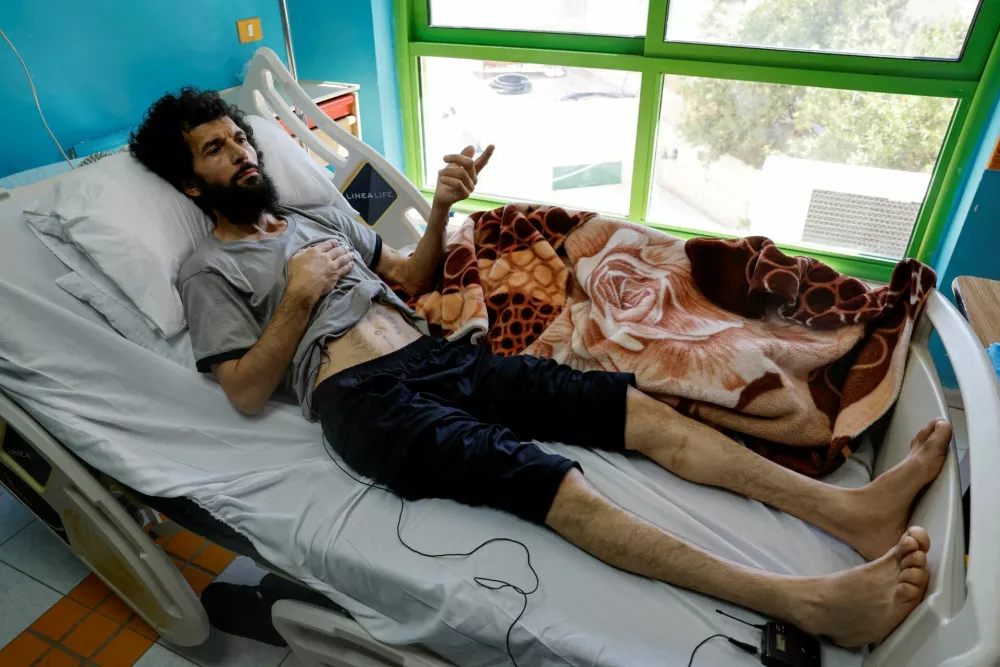 Palestinian Moazaz Obaiyat, who was released from Israeli jail, shows marks on his body, in a hospital in Bethlehem, in the Israeli-occupied West Bank July 11, 2024. REUTERS/Mussa Qawasma/File Photo