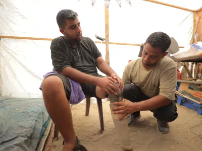 DEIR AL BALAH, GAZA - JULY 02: Muattaz Abu Dayeh (not seen), a physiotherapist, applies a medical prosthesis to 32-year-old worker Majd al-Omari (L), who lost part of his leg during the Israeli attacks with the help of his colleague Mahmud Salim (not seen) on the Shujaiyye neighborhood in Gaza's Deir Al Balah on July 02, 2024. As the Israeli army's attacks on Gaza Strip continue, Dayeh produces prostheses using simple wood and plastic materials. Hassan Jedi / AnadoluNo Use USA No use UK No use Canada No use France No use Japan No use Italy No use Australia No use Spain No use Belgium No use Korea No use South Africa No use Hong Kong No use New Zealand No use Turkey