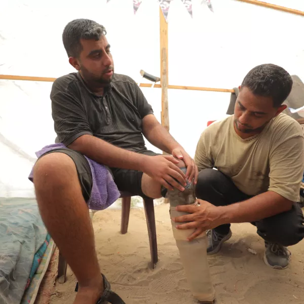 DEIR AL BALAH, GAZA - JULY 02: Muattaz Abu Dayeh (not seen), a physiotherapist, applies a medical prosthesis to 32-year-old worker Majd al-Omari (L), who lost part of his leg during the Israeli attacks with the help of his colleague Mahmud Salim (not seen) on the Shujaiyye neighborhood in Gaza's Deir Al Balah on July 02, 2024. As the Israeli army's attacks on Gaza Strip continue, Dayeh produces prostheses using simple wood and plastic materials. Hassan Jedi / AnadoluNo Use USA No use UK No use Canada No use France No use Japan No use Italy No use Australia No use Spain No use Belgium No use Korea No use South Africa No use Hong Kong No use New Zealand No use Turkey