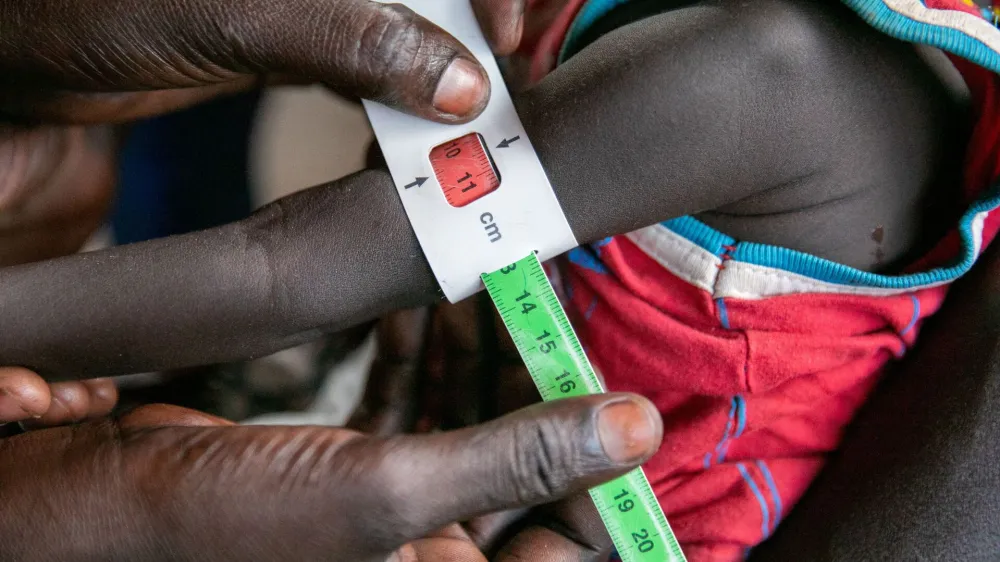 Regina Williams is screened for malnutrition at the Nyong Primary Health Care Unit (PHCU) nutrition site in Torit, where the World Food Programme (WFP) is implementing the blanket supplementary feeding programme (BSFP) nutrition activities, to children, pregnant and lactating women in Torit, within Eastern Equatorial State, of South Sudan, in this photo released November 3, 2022. World Food Programme/Handout via REUTERS THIS IMAGE HAS BEEN SUPPLIED BY A THIRD PARTY. MANDATORY CREDIT.