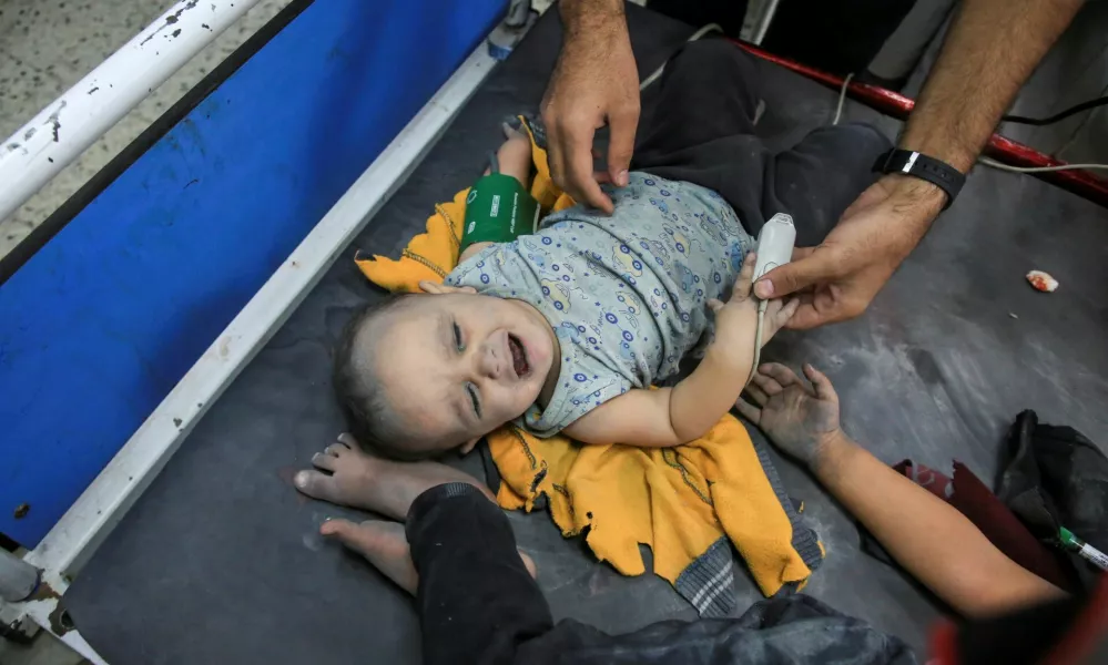 A Palestinian child wounded in an Israeli strike receives treatment at Al-Ahli hospital, amid the ongoing Israel-Hamas conflict, in Gaza City, October 26, 2024. REUTERS/Mahmoud Sameer