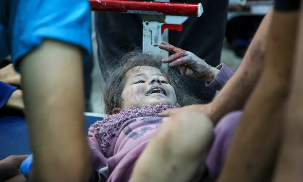  SENSITIVE MATERIAL. THIS IMAGE MAY OFFEND OR DISTURB  A Palestinian girl wounded in an Israeli strike receives treatment at Al-Ahli hospital, amid the ongoing Israel-Hamas conflict, in Gaza City, October 26, 2024. REUTERS/Mahmoud Sameer